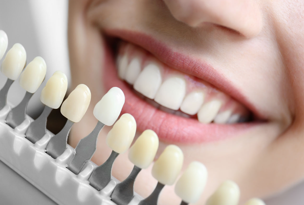 mejor blanqueador dental ocu